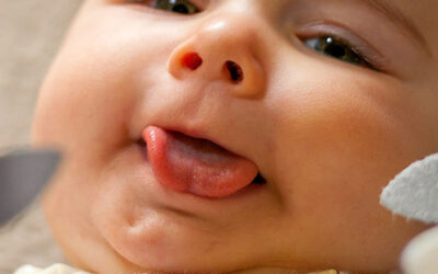 Lip and Tongue Ties: A Guide for Parents