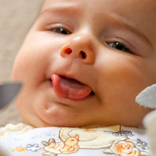 Lip and Tongue Ties: A Guide for Parents