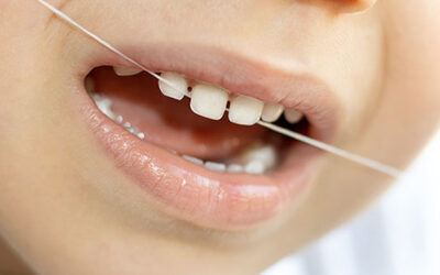 Jumpstart Your Child’s Lifetime Flossing Habit